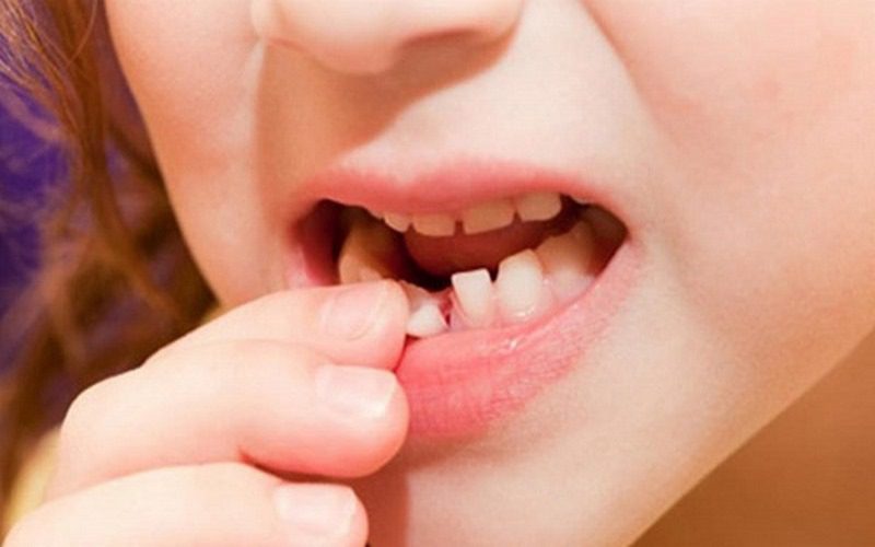 Mơ thấy rụng răng hàm dưới mang đến điềm báo điều gì?